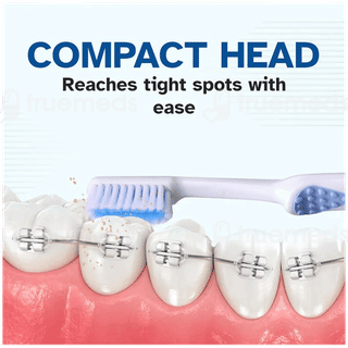 Stim Ortho Mb Super Soft Toothbrush 1