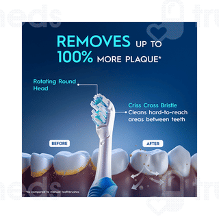 Oral B Cross Action Power Toothbrush 1