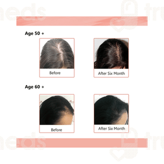 Sheneed Hair Supplement Capsule 60