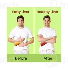 Cipzer Fatty Liver Solution Capsule 60