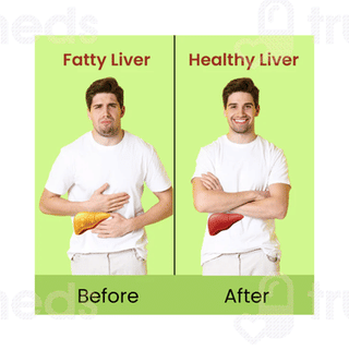 Cipzer Fatty Liver Solution Capsule 60