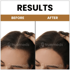 Myupchar Ayurveda Kesh Art Bhringraj Hair Cleanser 200ml