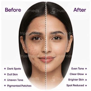 Kozilite H Skin Lightening Cream 20Gm