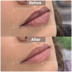 Lipz Spf 15 Lip Moisturiser 9Gm