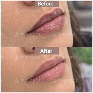 Lipz Spf 15 Lip Moisturiser 9Gm