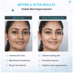 Sefpil Cream 30gm