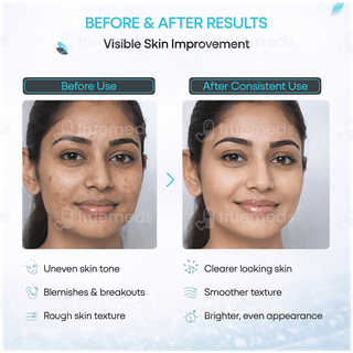 Sefpil Cream 30gm