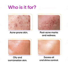 Akmasq Pimple Care Complexion Mask 75Gm