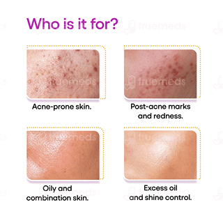 Akmasq Pimple Care Complexion Mask 75Gm