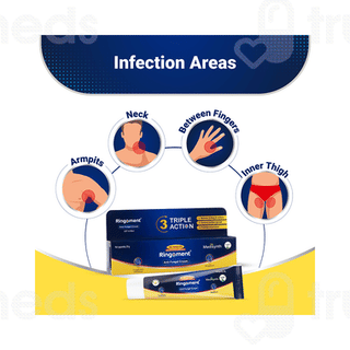 Medisynth Ringoment Anti Fungal Cream 20gm