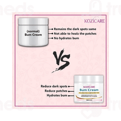 Kozicare Bum Cream 50gm