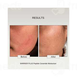 The Formularx Barrier Plus Peptide Ceramide Moisturizer 50gm
