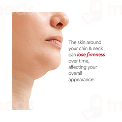 Vlcc Clinic Prosculpt Chin & Neck Line Firming Cream 100gm