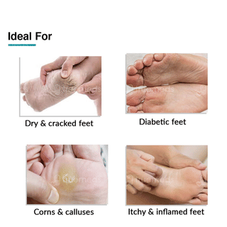 Fixderma Foobetik Cream 50Gm