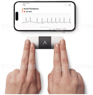 Alivecor Kardiamobile 6l Six Lead Ecg Device 1