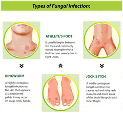 Tetmosol Fresh Lime Fragrance Dusting Powder 100gm