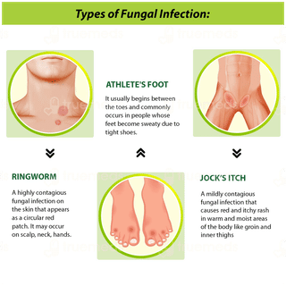 Tetmosol Fresh Lime Fragrance Dusting Powder 100gm