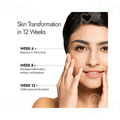 Kapiva Skin Foods Acne Ease Fizz Effervescent Tablet 20 Kapiva Skin Foods Acne Ease Fizz Effervescent Tablet 20