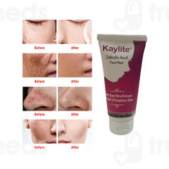 Kaylite Salicylic Acid Face Wash 60ml