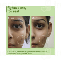 Plum Green Tea Pore Cleansing Glycolic Acid Face Wash 100ml