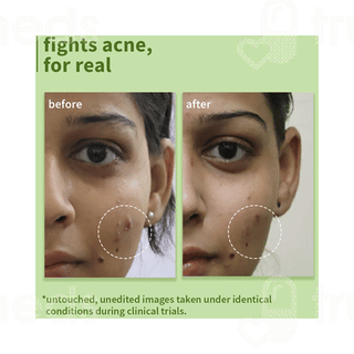 Plum Green Tea Pore Cleansing Glycolic Acid Face Wash 100ml