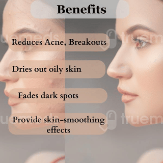 Dermistry Anti Acne Deep Cleansing Foaming Face Wash 150Ml