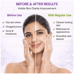 Acmed Plus Foaming Face Wash 150Ml