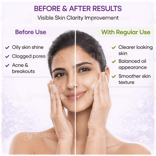 Acmed Plus Foaming Face Wash 150Ml