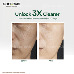 Goodcare Aloe Vera Foaming Face Wash 150Ml