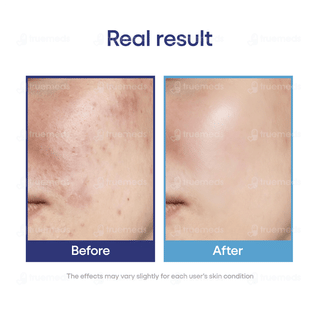 Hyalugel Plus Gel 30gm