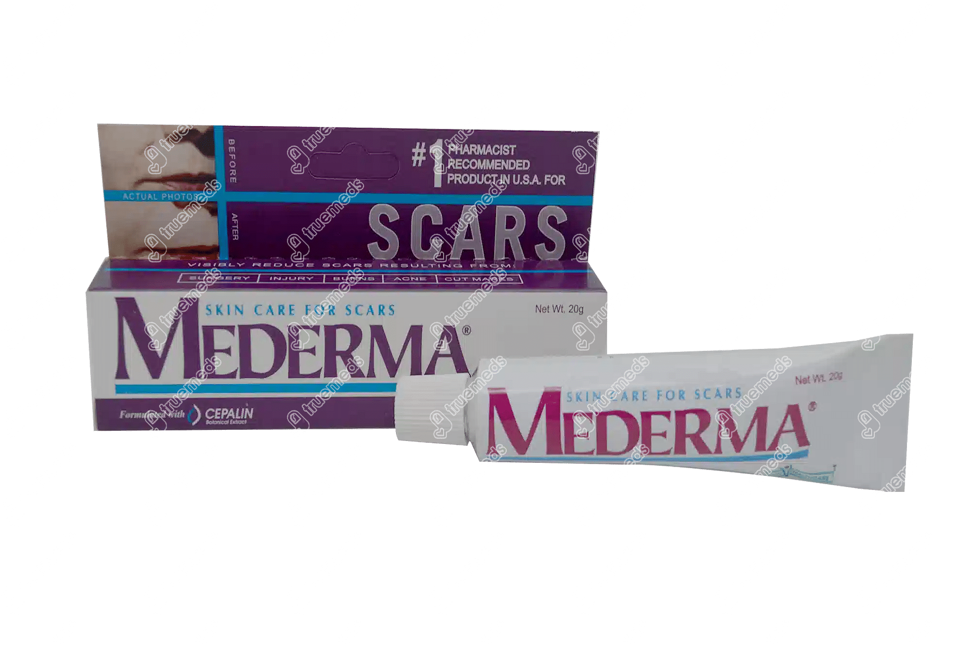 Mederma Gel 20 Gm Uses Side Effects Dosage Price Truemeds 1952