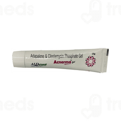 Acnerma Gel 15Gm Acnerma Gel 15Gm