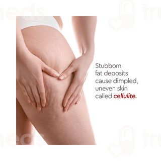 Vlcc Clinic Prosculpt Cellulite Reduction Gel 90gm