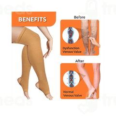 Vissco Core 0707 Varicose Vein Stockings Large Beige Pair 1