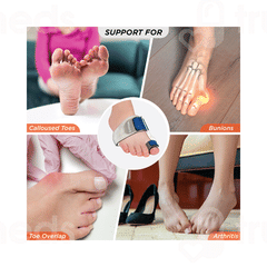 Vissco Core Bunion Splint 0729 Universal 1