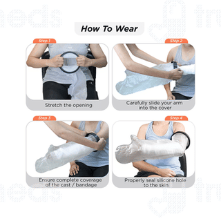 Vissco Core Cast Cover Arm From Wrist Upto Upper Arm Universal Grey 1