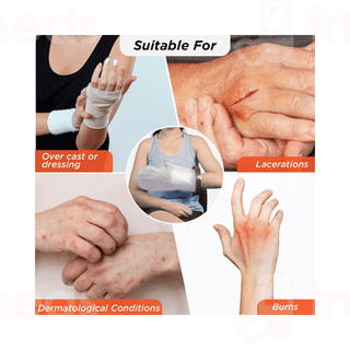 Vissco Core Cast Cover Arm Upto Wrist Universal Grey 1