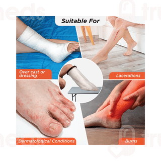 Vissco Core Cast Cover Leg From Ankle Upto Knee Universal Grey 1