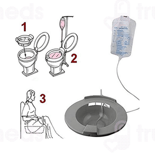 Isha Surgical Sitz And Piles Bath Tube 1