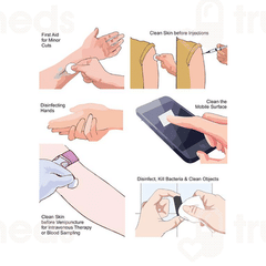 Control D Alcohol Swab Pack Of 100