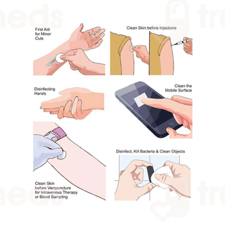 Control D Alcohol Swab Pack Of 100