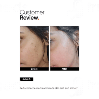 Minimalist Niacinamide 5%  Face Serum 30ml