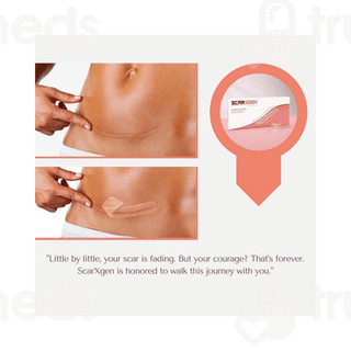Scarxgen 3cm X 15cm Silicone Gel Sheet 1