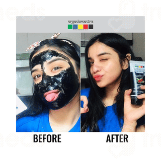 Organixmantra Activated Charcoal Peel Off Mask 120ml