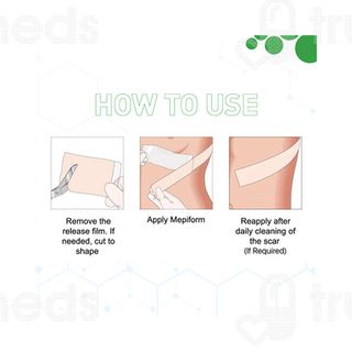 Epifect 100 MG Injection 1