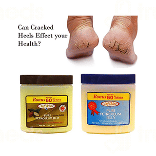 Sofskin Cocoa Butter Pure Petroleum Jelly 226 Gm