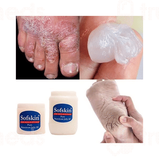Sofskin Pure Petroleum Jelly 500 Gm
