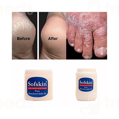 Sofskin Pure Petroleum Jelly 500 Gm Sofskin Pure Petroleum Jelly 500 Gm