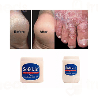Sofskin Pure Petroleum Jelly 500 Gm