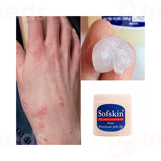 Sofskin Pure Petroleum Jelly 500 Gm